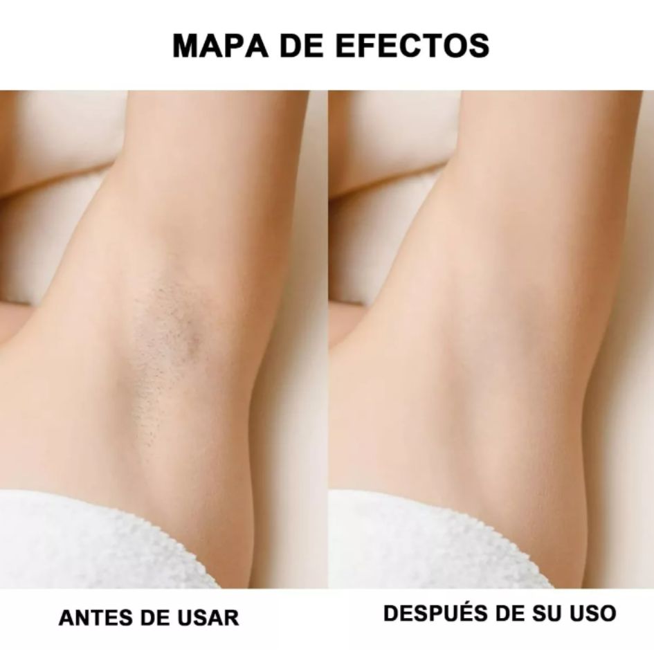 DEPILADORA MULTIUSOS PORTÁTIL